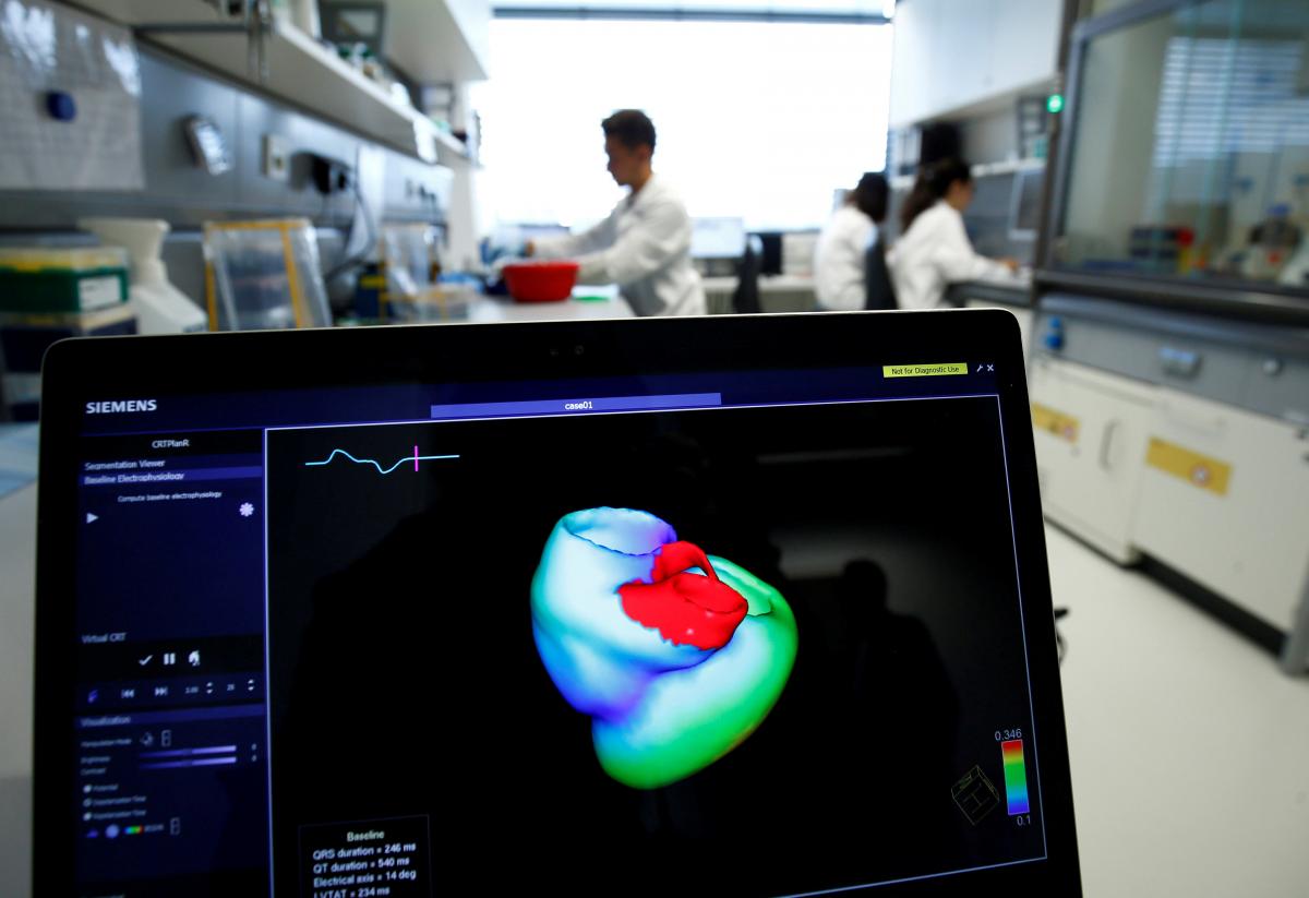 FILE PHOTO: A monitor shows a three-dimensional image of a human heart at the Klaus-Tschira-Institute for Integrative Computational Cardiology, department of the Heidelberg University Hospital (Universitaetsklinikum Heidelberg), in Heidelberg, Germany, August 14, 2018. REUTERS/Ralph Orlowski/File Photo